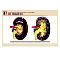 Рельефная таблица "Почка. Фронтальный разрез" (формат А1, матовое ламинир.) - «globural.ru» - Владимир